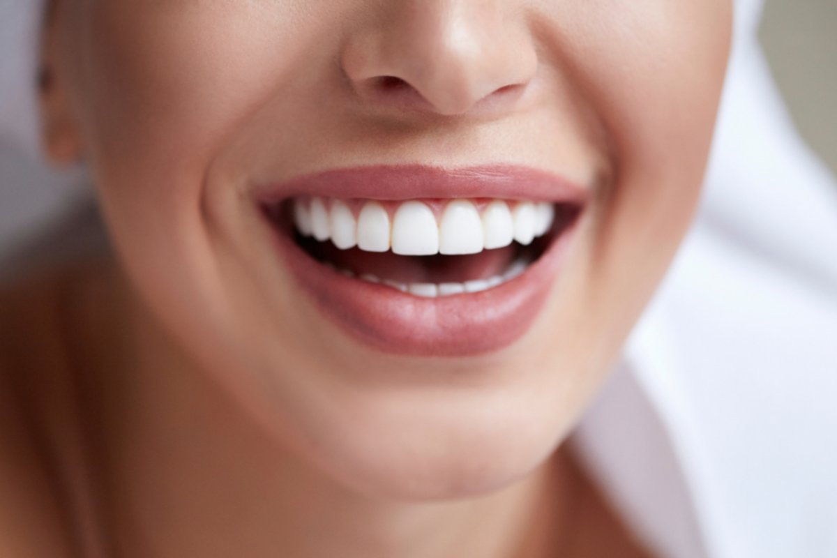Diş Estetiği ve Gülüş Tasarımı